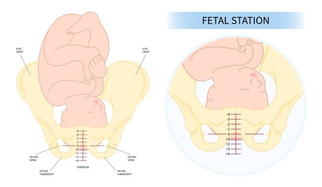 7 Ciri-Ciri Janin Masuk Panggul yang Perlu Diketahui - Pregnabel