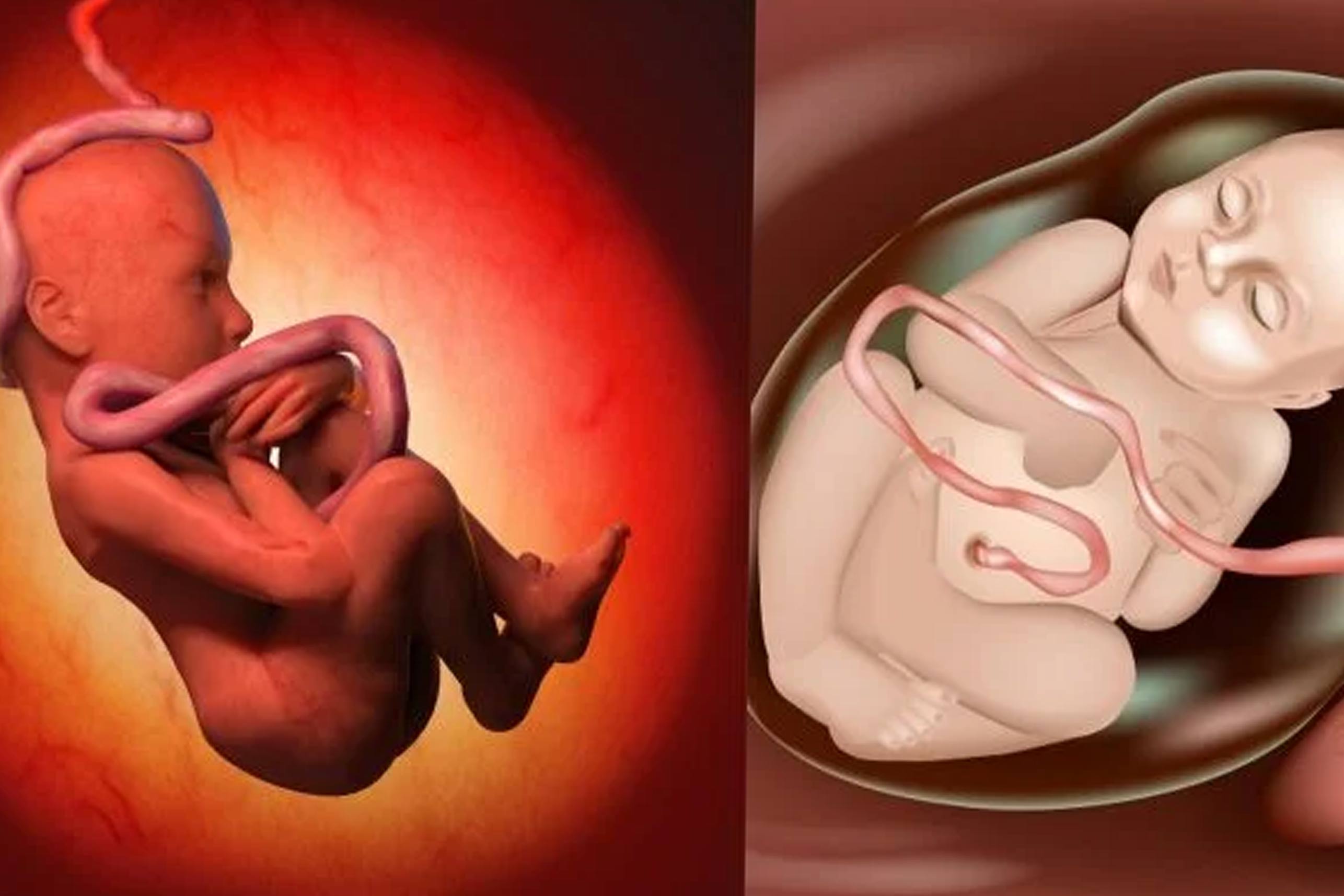 Bayi Terlilit Tali Pusar Karena Faktor Ini - Pregnabel