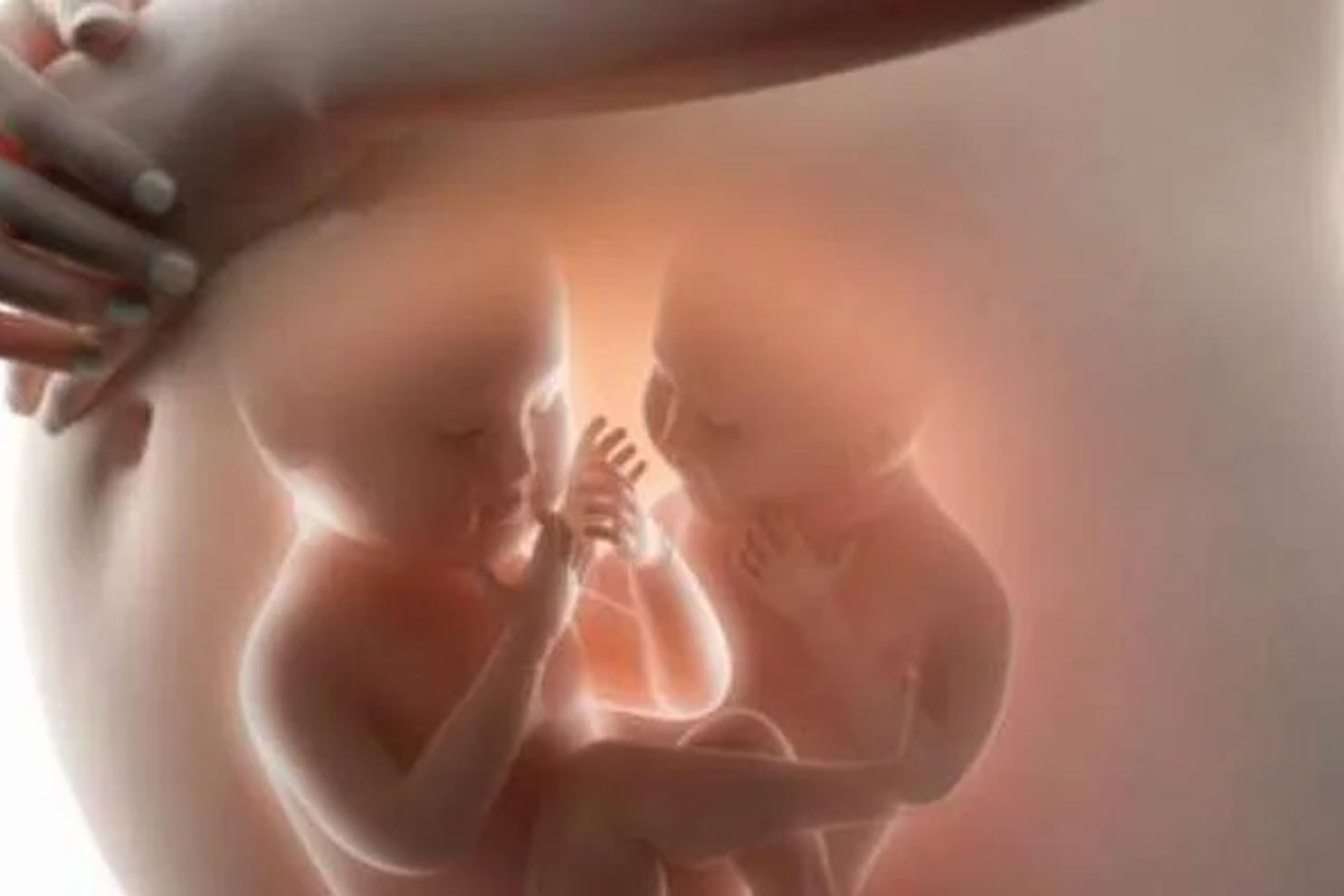 Ciri-Ciri Kehamilan Kembar yang Perlu Diketahui - Pregnabel